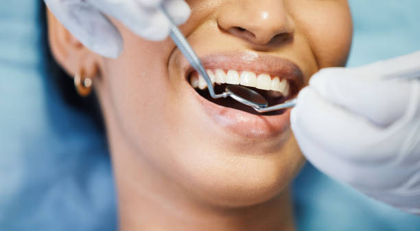 Best Emergency Treatment for Dental Infections or Abscesses in Alamo, CA