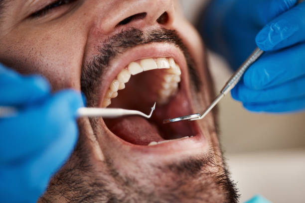 Best Emergency Treatment for Dental Infections or Abscesses in Alamo, CA